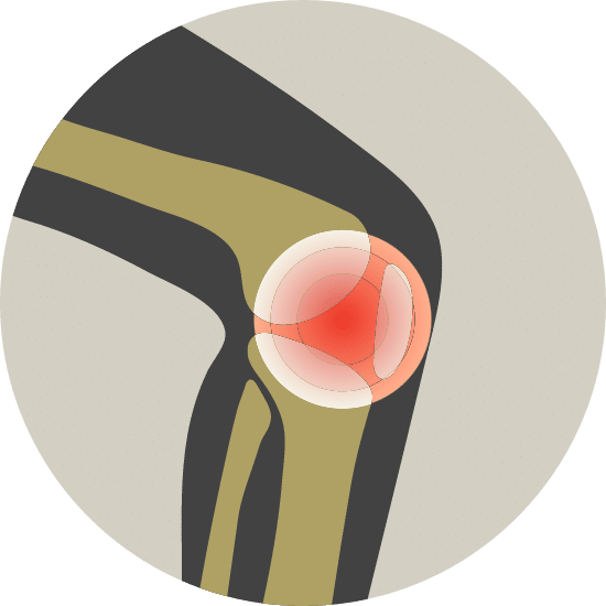 Knee pain icon
